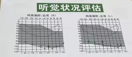 峰力奥笛･天朗助听器，超出我的预期-上海吴女士试听反馈